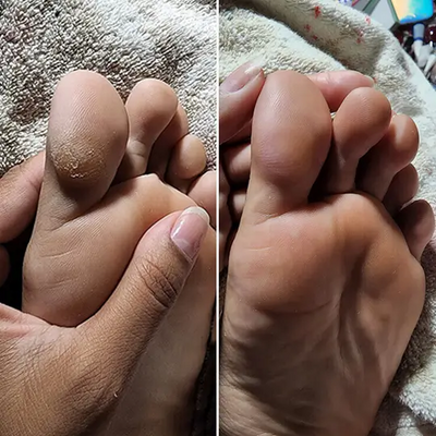 fjerner hård hud Elektrisk hudfil